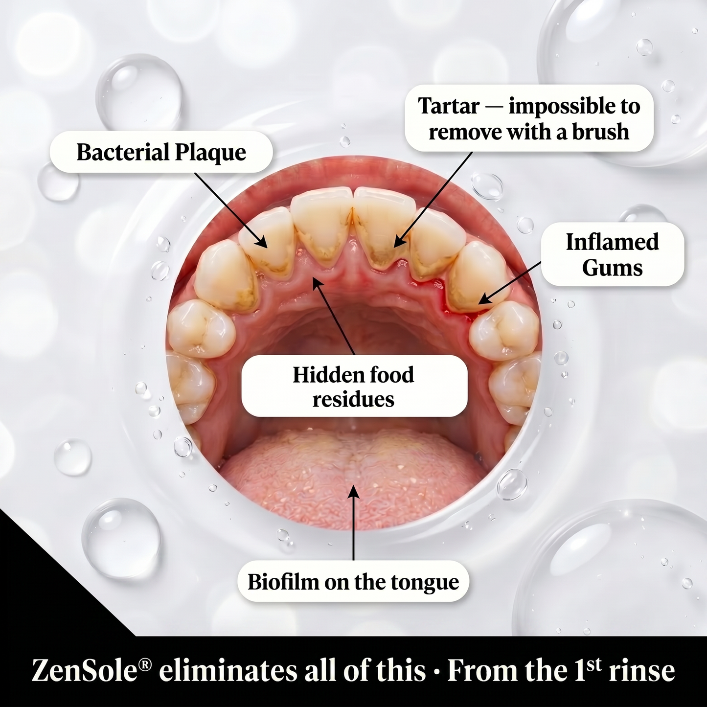 ZenSole® Whitening Mouthwash